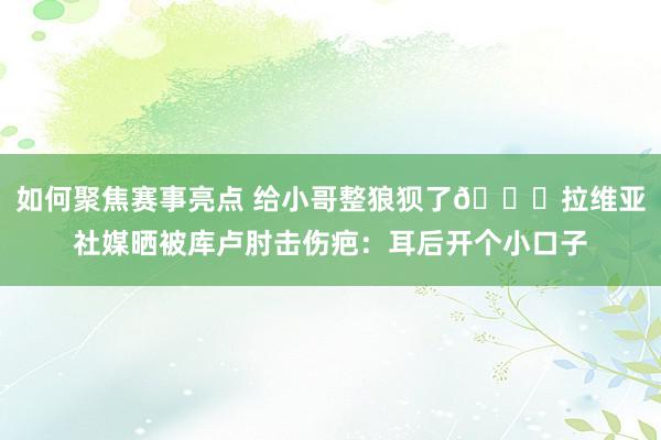 如何聚焦赛事亮点 给小哥整狼狈了😅拉维亚社媒晒被库卢肘击伤疤：耳后开个小口子